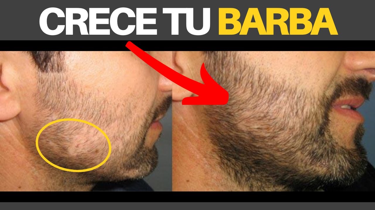 Como me puede salir mas barba - Diario Villacarrillo